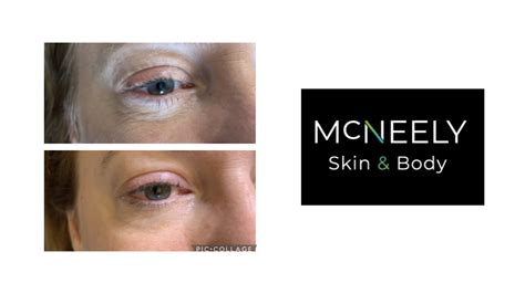 McNeely Skin and body- Aesthetics and Skincare