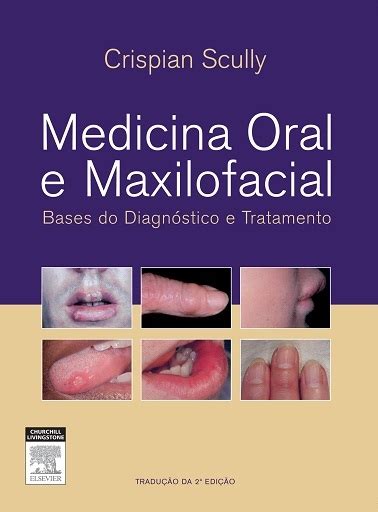 download Medicina oral e maxilofacial: Bases do diagnóstico e tratamento