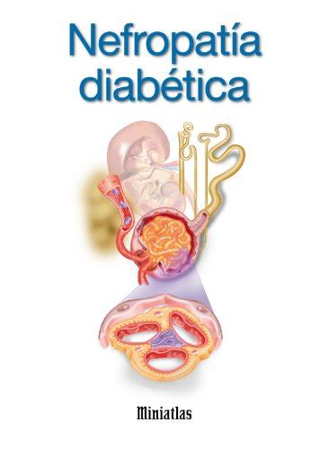 [!!] Free Miniatlas: Nefropatía diabética Pdf Books