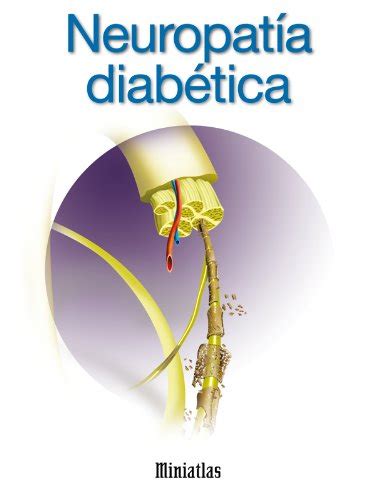 # Download Pdf Miniatlas: Neuropatía diabética Books