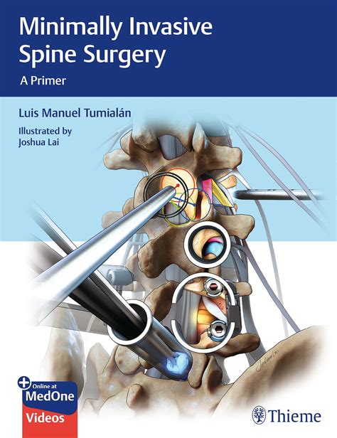 ^ Download Pdf Minimally Invasive Spine Surgery Books