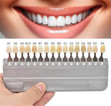 Natural Teeth Colour Chart