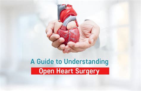 download Open Heart Surgery