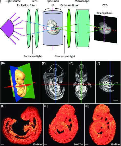 Tomography