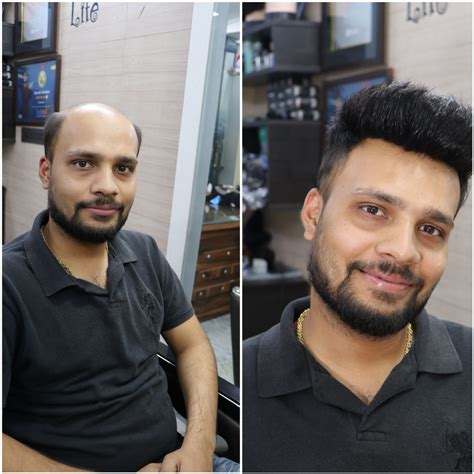 Pal hair wig studio hair replacement hair style hair non surgical jodhpur barmer balotra