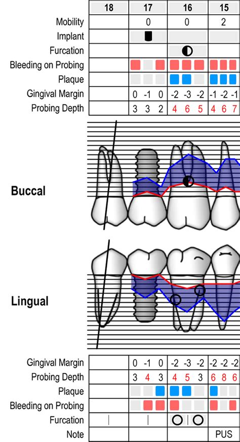 Periodontal Probing Chart