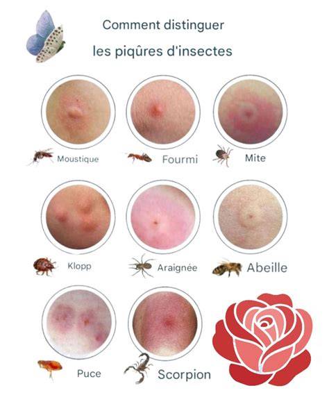 Pique Tout Net à Toulouse