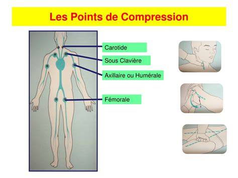 Point de compression à Baubigny