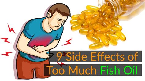 Potential Side Effects of Omega Fish Oil Supplements