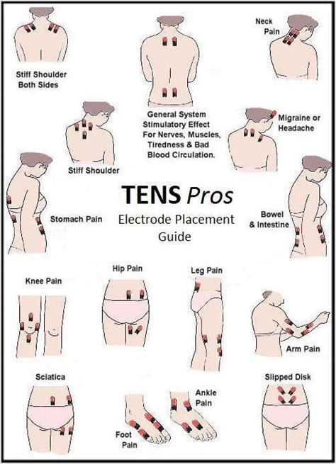 Proper Placement of Electrodes for TCM