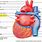 Pulmonary Vein