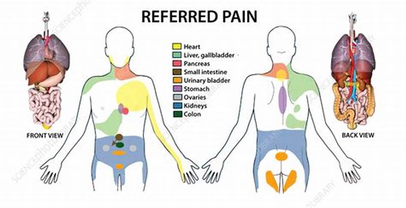 Referred Pain Pattern