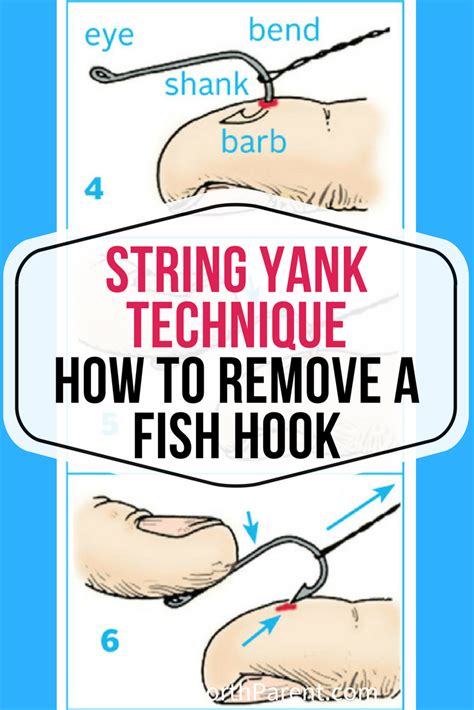 Remove the Hook Gently