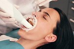 Reviews for Dental Clean
