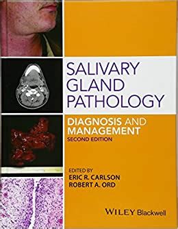 download Salivary Gland Pathology