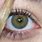 Sectoral Heterochromia Hazel Eyes