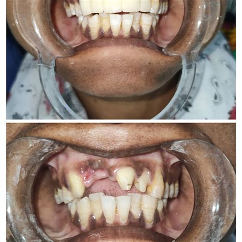 Shanti seva sadan dental clinic,rajgangpur