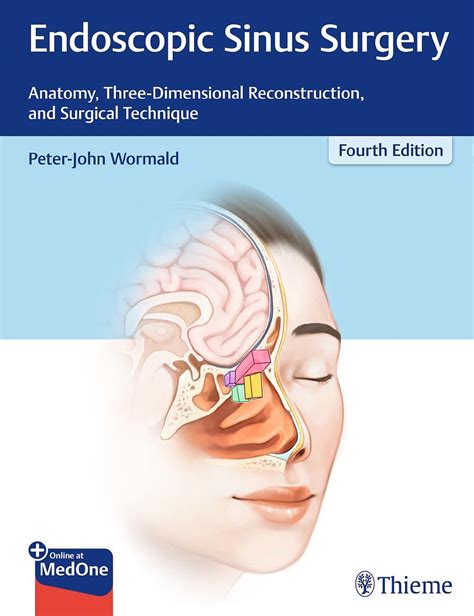download Sinus Surgery