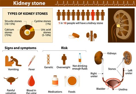Size Chart For Kidney Stones