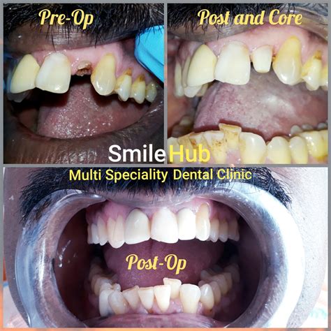 Smile Hub Multi Speciality Dental Clinic