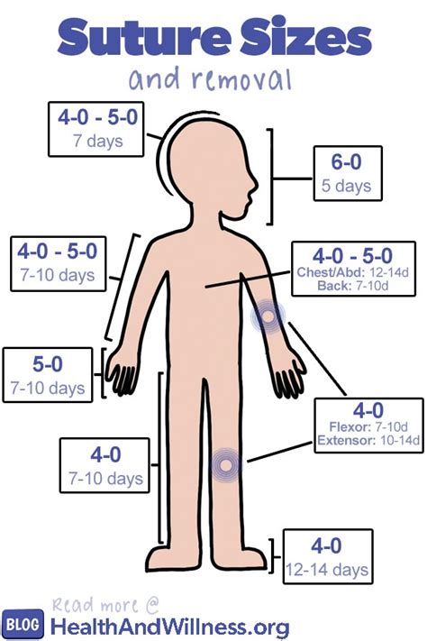 Suture Sizes Chart