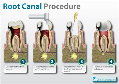 THUMAR DENTAL HOSPITAL - Best Dentist | Root Canal | Dental Implants Treatment in Junagadh