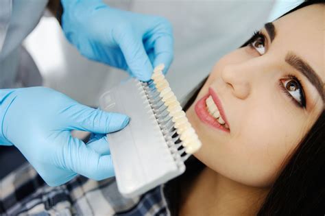 Teeth whitening service