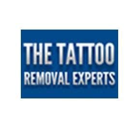 The Tattoo Removal Experts