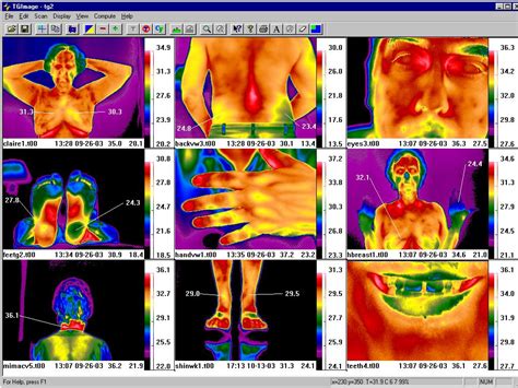 Thermal Imager Apps for health
