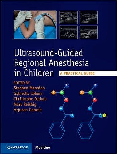 download Ultrasound-Guided Regional Anesthesia in Children