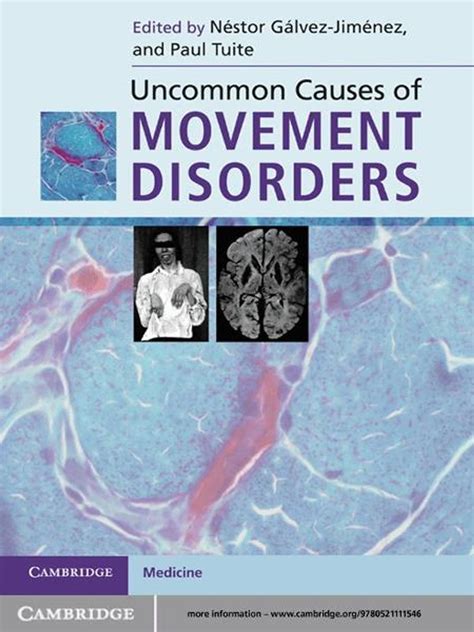 [^^] Free Uncommon Causes of Movement Disorders Pdf Books
