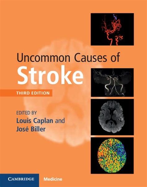 %% Download Pdf Uncommon Causes of Stroke Books