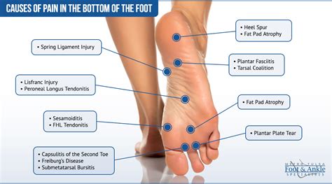 Under Foot Pain Chart