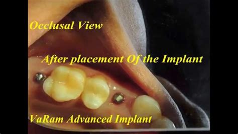 VaRam Dental Trauma Surgery + Implants & Orthodontic Hospital