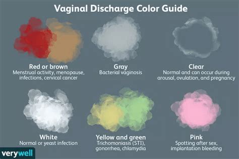 Vag Discharge Color Chart