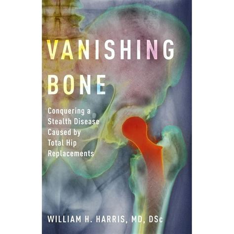 download Vanishing Bone
