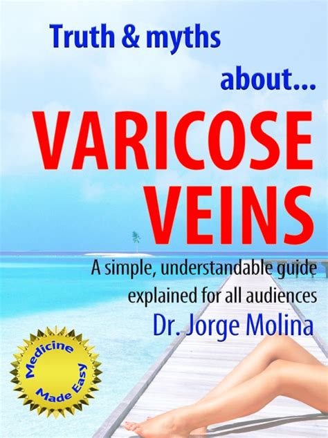 download Varicose Veins