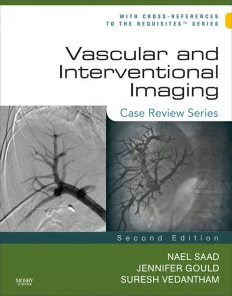download Vascular and Interventional Imaging: Case Review Series E-Book