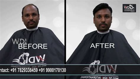 WDI Hair Studio, Hair Fixing in Bangalore, Bonding, Extensions, Wigs, Replacements