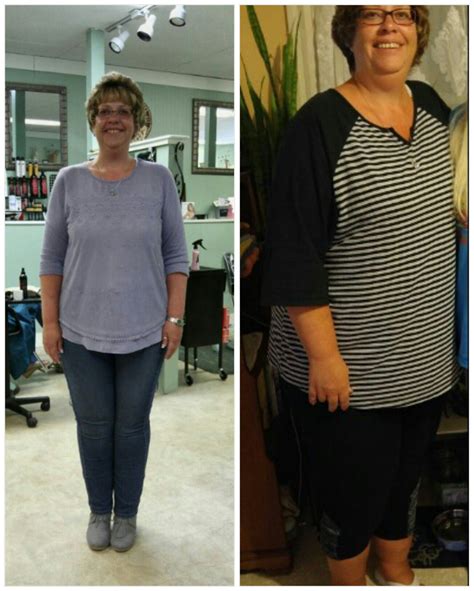 Weight Loss Consultant Worcester