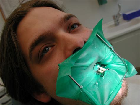 Zahnarztpraxis Kofferdam für Wurzelkanalbehandlung - Georg Benjamin