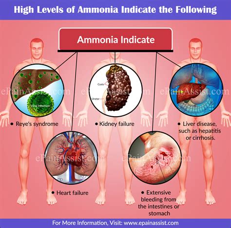 High Ammonia levels