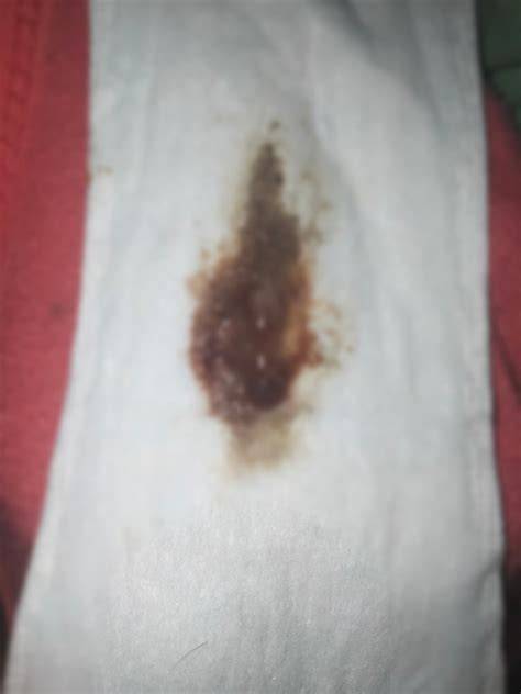 flek coklat