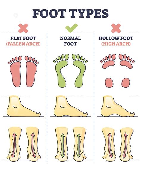 Foot Types Chart