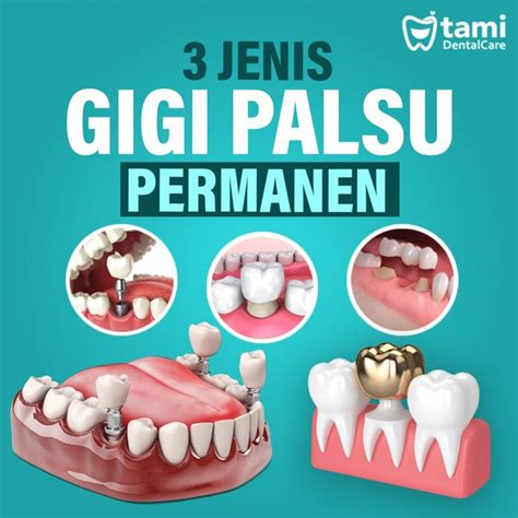 Jenis gigi palsu di Indonesia