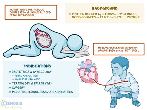 Knee Chest Position