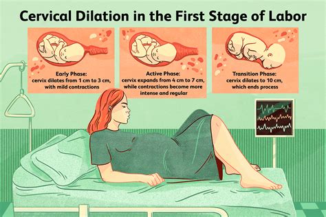 Labor Contractions Chart