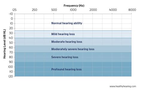 Levels Of Hearing Loss Chart