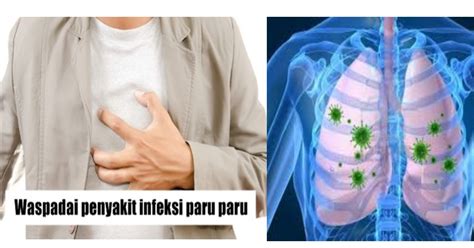 pengobatan penyakit paru makassar