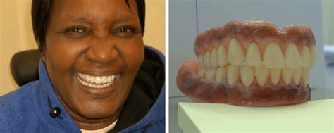 sMiles Better - Dentures in Manchester